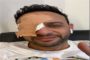 هي الأولى من نوعها بالضفة منذ الانتفاضة الثانية.. إرتقاء 3 شهداء في عملية قصف جوي إسرائيلي استهدف مركبتهم