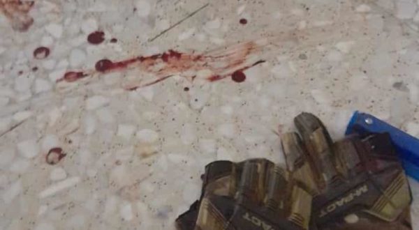 نجاة شاب فلسطيني وإصابة ضابط صهيوني بنيران زميله قرب نابلس