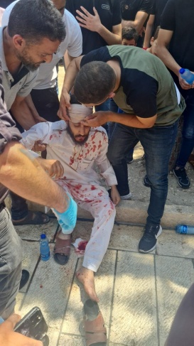 إصابة 8 مقدسيين بجروح ورضوض إثر اعتداء قوات العدو الإسرائيلي، اليوم الجمعة، على المصلين في المسجد الأقصى/ فيديو